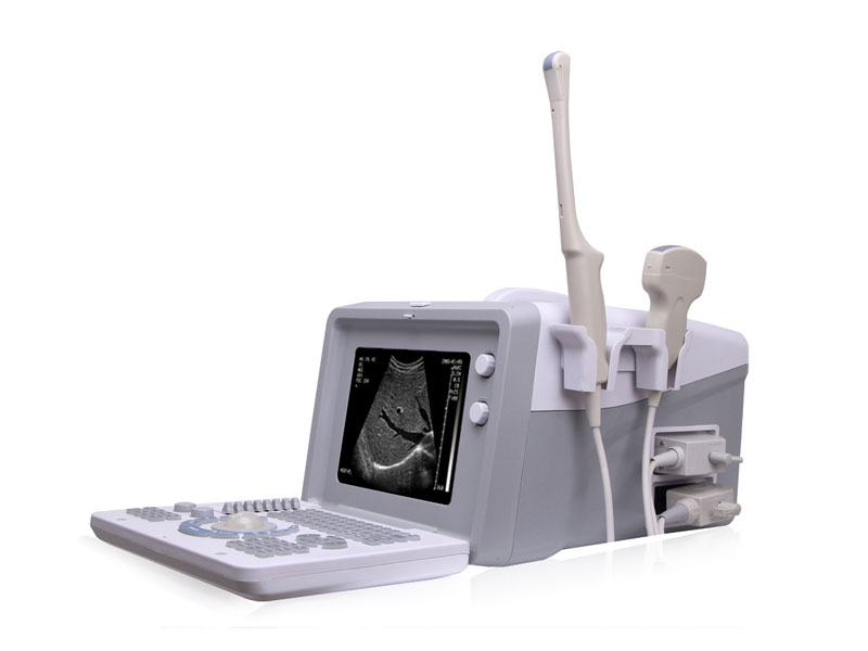 Digital Portable Ultrasound Scanner 