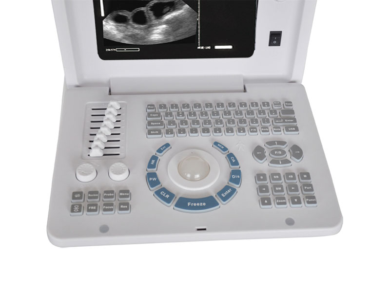 Veterinary Laptop Ultrasound Scanner
